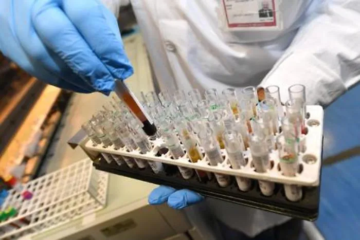 Laboratorio analisi