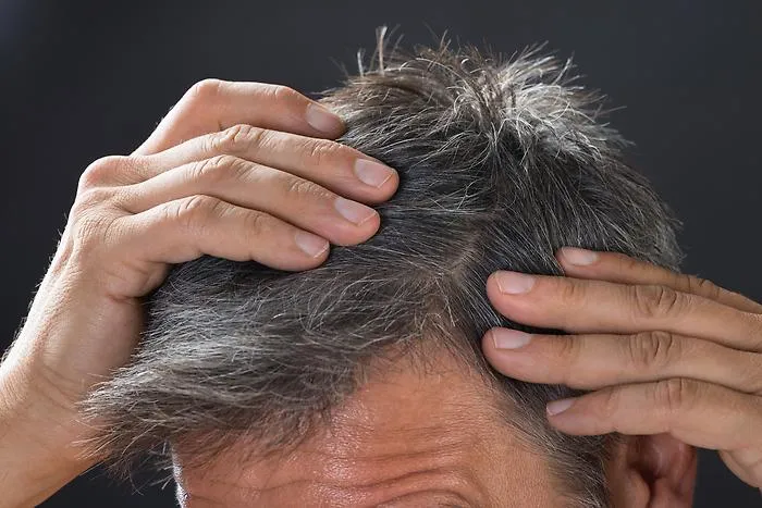 Speranze per combattere la calvizie, nelle cellule adipose il segreto per far ricrescere i  capelli