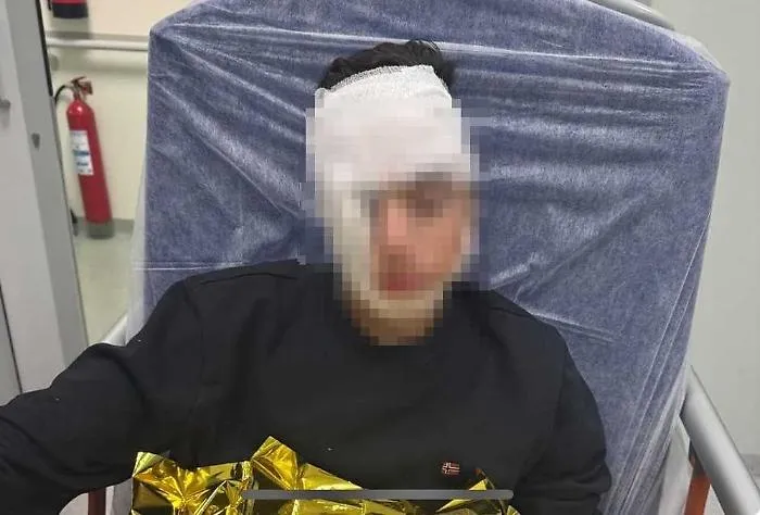 Ragazzino pestato da una baby gang in piazza Stesicoro a Catania: padre posta la foto e scatta l'appello per pi&ugrave; sicurezza