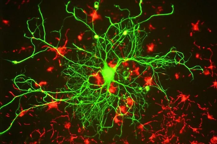 Lo studio dell'istituto di Cristallografia di Catania sulla molecola smart contro l'Alzheimer, aiuta le difese naturali