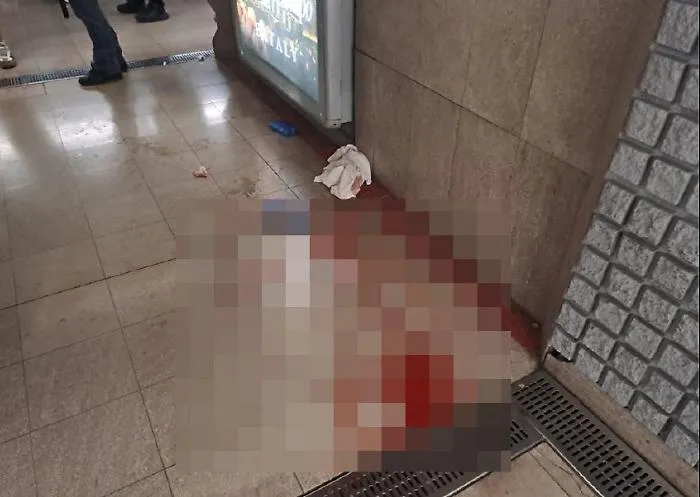 "Che cos&rsquo;hai da guardare. Sono uomo e sono musulmano": e sfregia una ragazza di 23 anni