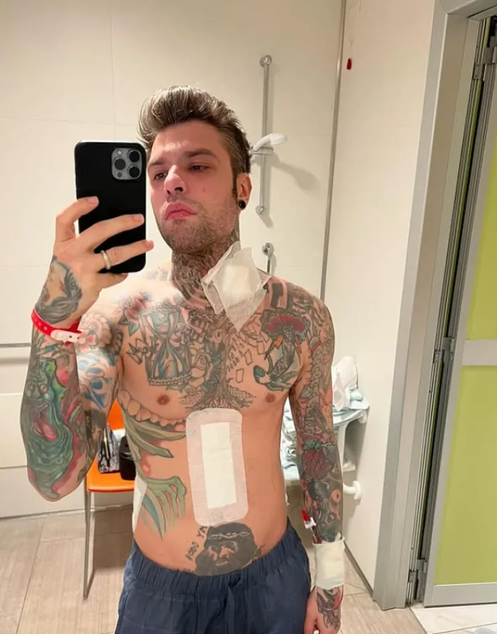 Fedez resta ricoverato: trasferito all'Humanitas di Rozzano