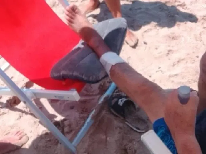 Turisti morsi in mare da pesci a Palinuro con copiose perdite di sangue: due le specie sott'accusa
