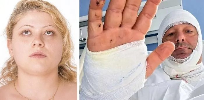 Lo sfregio, la fuga, la cattura: la donna &ldquo;tradita&rdquo; dal cellulare